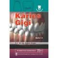 Karies Gigi